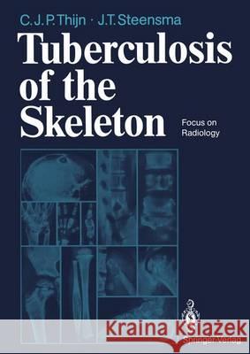 Tuberculosis of the Skeleton: Focus on Radiology Thijn, Cornelis J. P. 9783642746673 Springer - książka