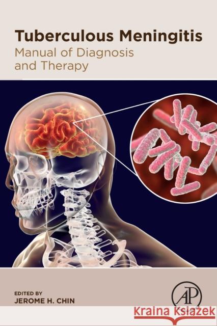 Tuberculous Meningitis: Manual of Diagnosis and Therapy Jerome H. Chin 9780128188255 Academic Press - książka