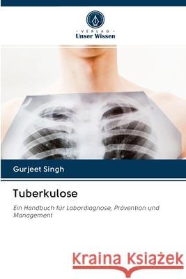 Tuberkulose Singh, Gurjeet 9786202871228 Verlag Unser Wissen - książka