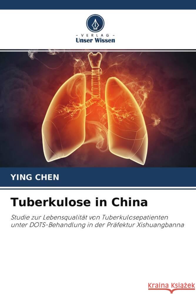 Tuberkulose in China Chen, Ying 9786203524765 Verlag Unser Wissen - książka