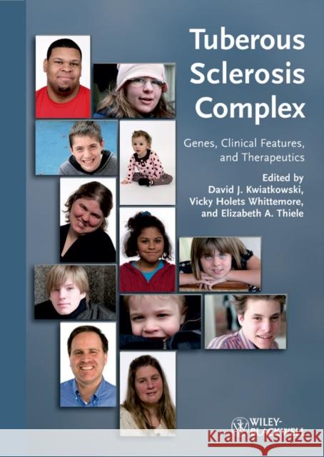 Tuberous Sclerosis Complex: Genes, Clinical Features and Therapeutics Kwiatkowski, David J. 9783527322015 Wiley-VCH Verlag GmbH - książka