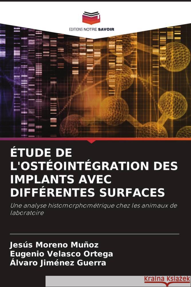 ÉTUDE DE L'OSTÉOINTÉGRATION DES IMPLANTS AVEC DIFFÉRENTES SURFACES Moreno Muñoz, Jesús, Velasco Ortega, Eugenio, Jiménez Guerra, Álvaro 9786204661650 Editions Notre Savoir - książka