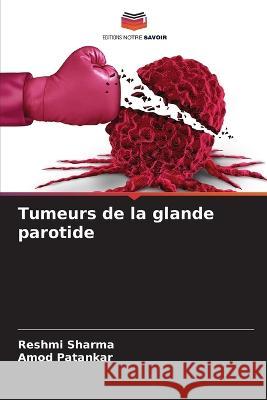 Tumeurs de la glande parotide Reshmi Sharma Amod Patankar 9786205671580 Editions Notre Savoir - książka