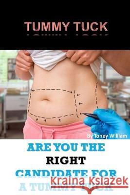 Tummy Tuck: Are You The Right Candidate For A Tummy Tuck William, Tony 9781974097098 Createspace Independent Publishing Platform - książka