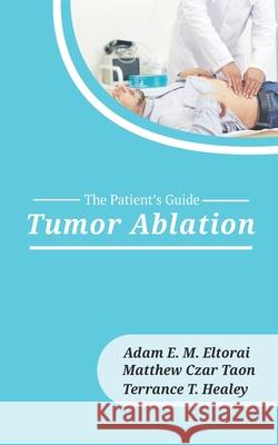 Tumor Ablation Matthew Czar Taon Terrance Healey Adam E. M. Eltorai 9781946665287 Praeclarus Press - książka