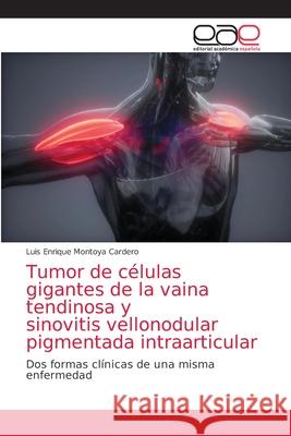 Tumor de células gigantes de la vaina tendinosa y sinovitis vellonodular pigmentada intraarticular Luis Enrique Montoya Cardero 9786203871494 Editorial Academica Espanola - książka