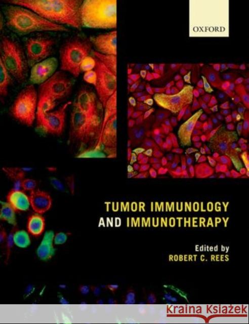 Tumor Immunology and Immunotherapy Robert C. Rees 9780199676866 Oxford University Press, USA - książka