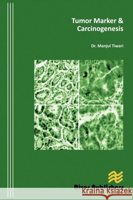 Tumor Marker and Carcinogenesis Manjul Tiwari 9788792329370 River Publishers - książka