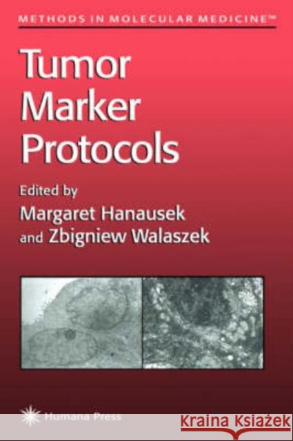 Tumor Marker Protocols Margaret Hanausek Zbigniew Walaszek 9780896033801 Humana Press - książka