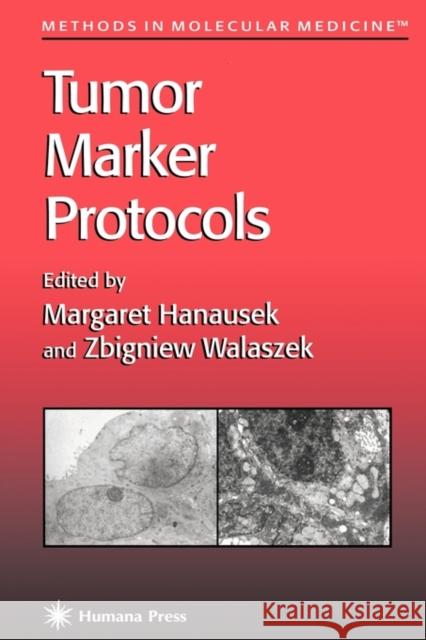 Tumor Marker Protocols Margaret Hanausek Zbigniew Walaszek 9781617370199 Springer - książka