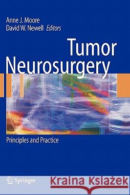Tumor Neurosurgery: Principles and Practice Anne J. Moore, David W. Newell 9781846282911 Springer London Ltd - książka