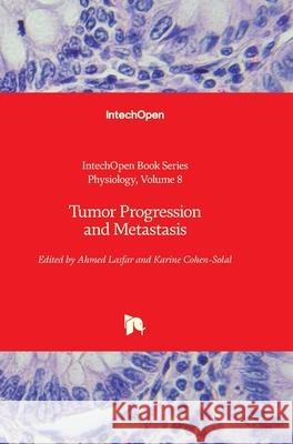 Tumor Progression and Metastasis Ahmed Lasfar, Karine Cohen-Solal 9781789853490 IntechOpen - książka