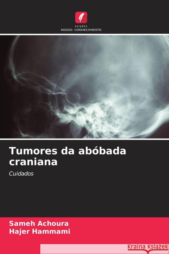 Tumores da ab?bada craniana Sameh Achoura Hajer Hammami 9786208060411 Edicoes Nosso Conhecimento - książka