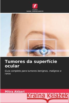 Tumores da superfície ocular Akbari, Mitra 9786207824427 Edições Nosso Conhecimento - książka