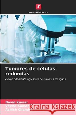 Tumores de c?lulas redondas Navin Kumar Veena Kumar Ashish Chandra 9786205853306 Edicoes Nosso Conhecimento - książka