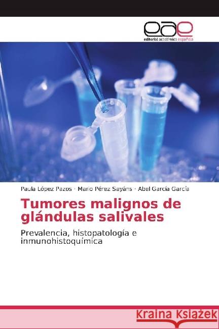 Tumores malignos de glándulas salivales : Prevalencia, histopatología e inmunohistoquímica López Pazos, Paula; Pérez Sayáns, Mario; García García, Abel 9783841756121 Editorial Académica Española - książka