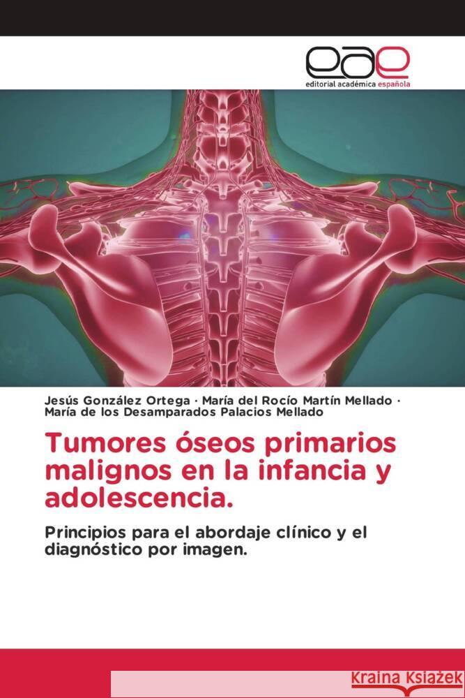 Tumores óseos primarios malignos en la infancia y adolescencia. González Ortega, Jesús, Martín Mellado, María del Rocío, Palacios Mellado, María de los Desamparados 9783330091641 Editorial Académica Española - książka