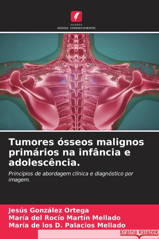 Tumores ósseos malignos primários na infância e adolescência. González Ortega, Jesús, Martín Mellado, María del Rocío, Palacios Mellado, María de los D. 9786205044032 Edições Nosso Conhecimento - książka