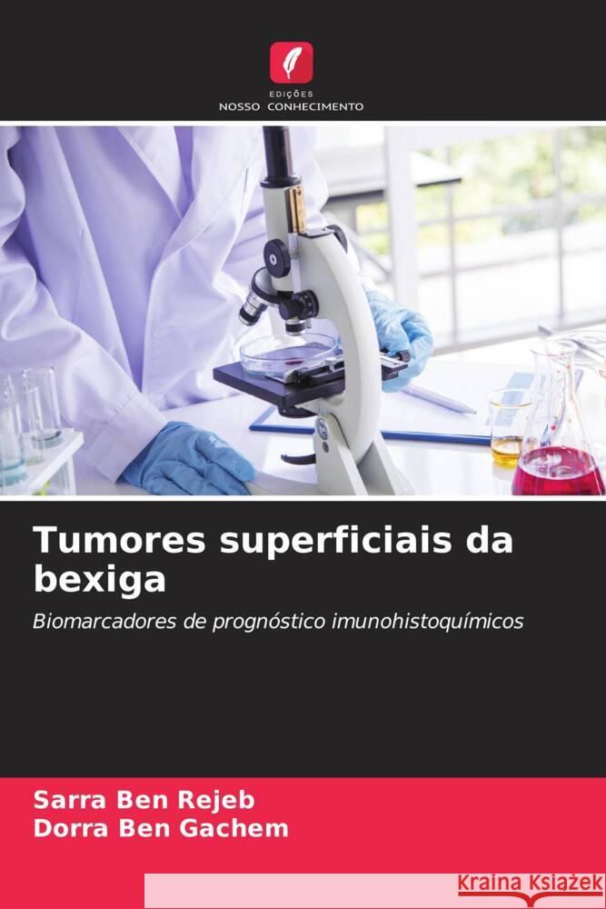 Tumores superficiais da bexiga Sarra Be Dorra Be 9786207189052 Edicoes Nosso Conhecimento - książka