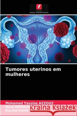 Tumores uterinos em mulheres Mohamed Yassine Azzouz, Nora Mimoune, Rachid Kaidi 9786202648622 Edicoes Nosso Conhecimento - książka