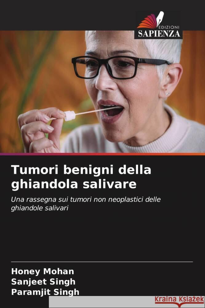 Tumori benigni della ghiandola salivare Mohan, Honey, Singh, Sanjeet, Singh, Paramjit 9786204786773 Edizioni Sapienza - książka