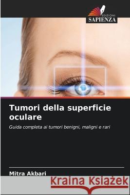 Tumori della superficie oculare Akbari, Mitra 9786207824403 Edizioni Sapienza - książka