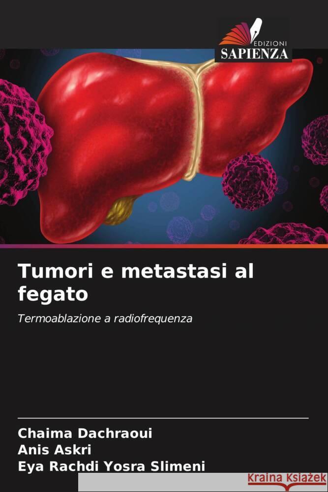 Tumori e metastasi al fegato Dachraoui, Chaima, Askri, Anis, Yosra Slimeni, Eya Rachdi 9786204377032 Edizioni Sapienza - książka