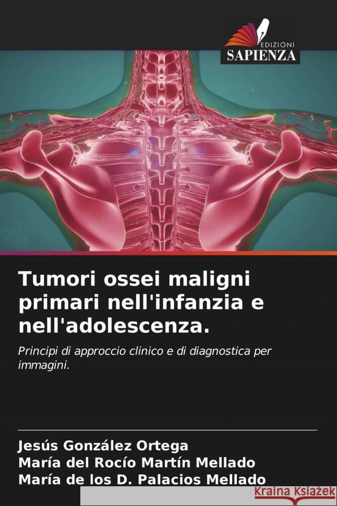 Tumori ossei maligni primari nell'infanzia e nell'adolescenza. González Ortega, Jesús, Martín Mellado, María del Rocío, Palacios Mellado, María de los D. 9786205044025 Edizioni Sapienza - książka