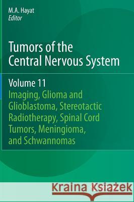 Tumors of the Central Nervous System, Volume 11: Pineal, Pituitary, and Spinal Tumors Hayat, M. A. 9789400770362 Springer - książka