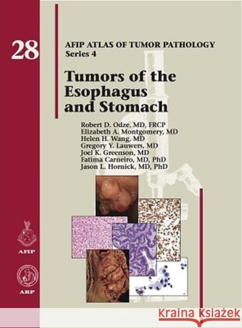 Tumors of the Esophagus and Stomach Robert D. Odze Elizabeth A. Montgomery Helen H. Wang 9781933477404 American Registry of Pathology - książka