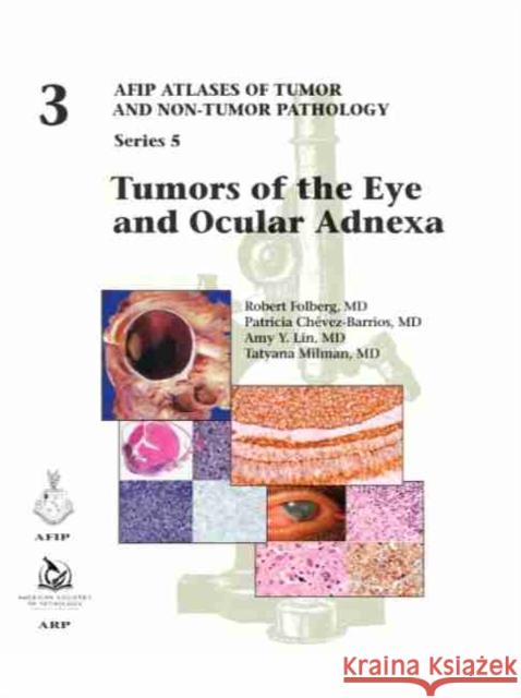 Tumors of the Eye and Ocular Adnexa Amy Y. Lin, Patricia Chévez-Barrios, Robert Folberg 9781933477923 American Registry of Pathology - książka