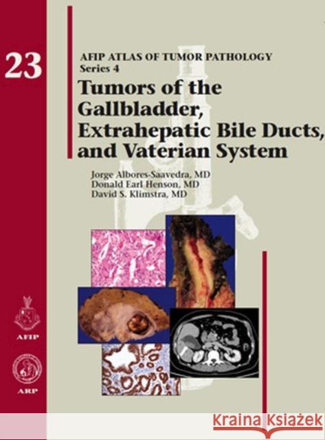 Tumors of the Gallbladder Extrahepatic Bile Ducts and Vaterian System Donald Earl Henson Jorge Albores-Saavedra David S. Klimstra 9781933477343 American Registry of Pathology - książka