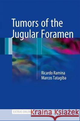 Tumors of the Jugular Foramen Ricardo Ramina Marcos Tatagiba 9783319433660 Springer - książka