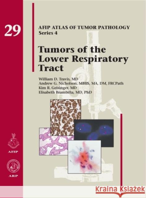 Tumors of the Lower Respiratory Tract William D. Travis, Andrew G. Nicholson, Kim R. Geisinger 9781933477466 Eurospan (JL) - książka