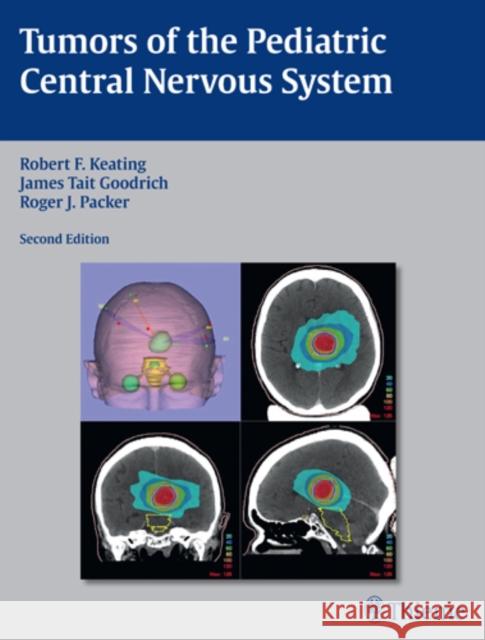 Tumors of the Pediatric Central Nervous System Robert Keating James Goodrich Roger Packer 9781604065466 Thieme Medical Publishers - książka