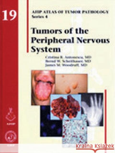 Tumors of the Peripheral Nervous System C R Antonescu B.W Scheithauer James M. Woodruff 9781933477305 American Registry of Pathology - książka