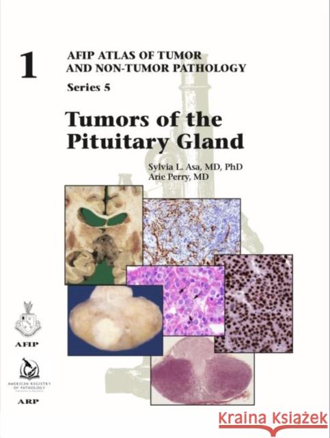 Tumors of the Pituitary Gland Sylvia L. Asa, Arie Perry 9781933477916 American Registry of Pathology - książka