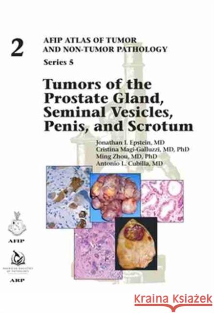 Tumors of the Prostate Gland, Seminal Vesicles, Penis, and Scrotum Jonathan I. Epstein Cristina Magi-Galluzzi Ming Zhou 9781933477909 American Registry of Pathology - książka