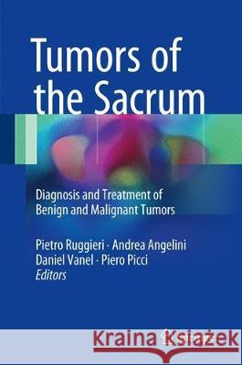 Tumors of the Sacrum: Diagnosis and Treatment of Benign and Malignant Tumors Ruggieri, Pietro 9783319512006 Springer - książka