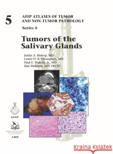 Tumors of the Salivary Glands: Series 5 Justin A. Bishop 9781933477947 American Registry of Pathology - książka