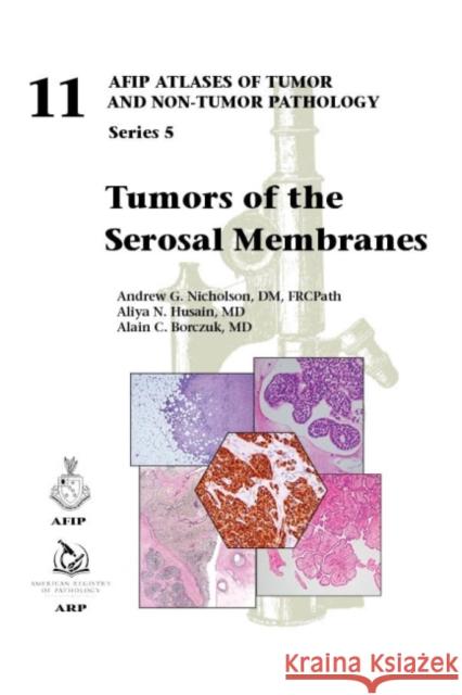 Tumors of the Serosal Membranes Alain Borczuk 9781933477190 American Registry of Pathology - książka