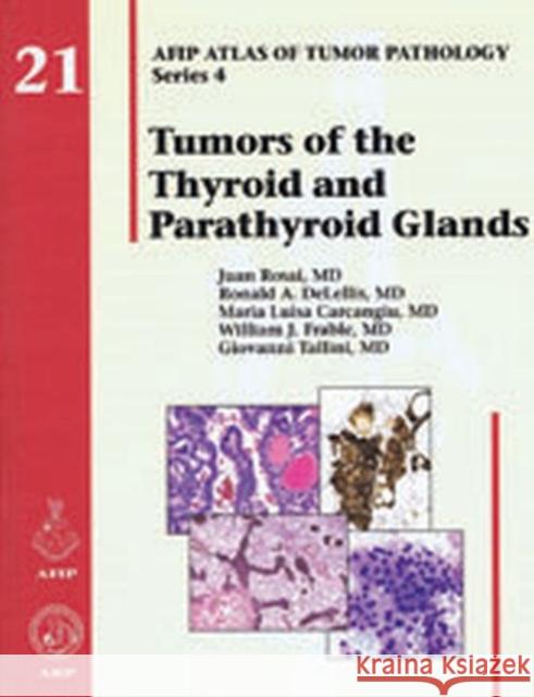 Tumors of the Thyroid and Parathyroid Glands Juan Rosai Ronald A. Delellis Maria Luisa Carcangiu 9781933477329 American Registry of Pathology - książka