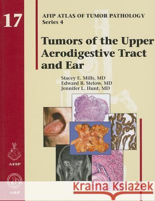 Tumors of the Upper Aerodigestive Tract and Ear Stacey E. Mills Edward B. Stelow Jennifer L. Hunt 9781933477206 American Registry of Pathology - książka