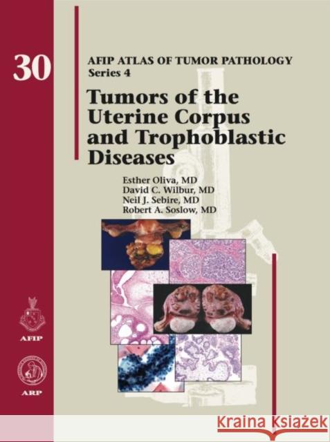 Tumors of the Uterine Corpus and Trophoblastic Diseases Oliva, Esther 9781933477480 American Registry of Pathology - książka