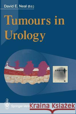 Tumours in Urology David E. Neal 9781447120889 Springer - książka