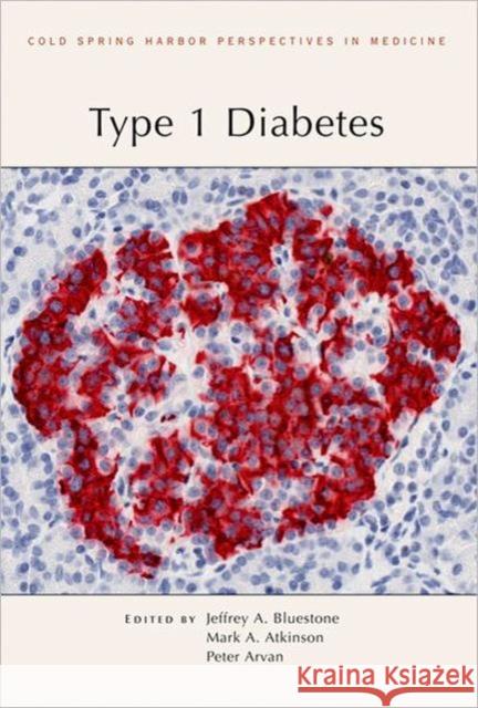 Type 1 Diabetes Jeffrey A. BlueStone Mark A. Atkinson Peter R. Arvan 9781936113217 Cold Spring Harbor Laboratory Press - książka