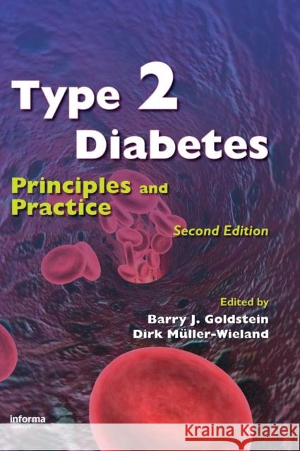 Type 2 Diabetes: Principles and Practice Goldstein, Barry J. 9780849379574 Informa Healthcare - książka