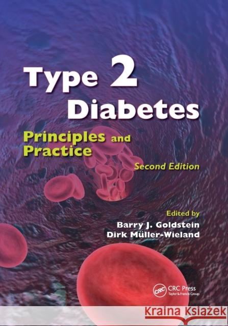 Type 2 Diabetes: Principles and Practice, Second Edition Barry J. Goldstein Dirk Mueller-Wieland 9780367388300 CRC Press - książka