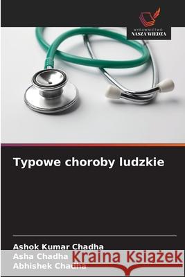 Typowe choroby ludzkie Ashok Kumar Chadha Asha Chadha Abhishek Chadha 9786209152016 Wydawnictwo Nasza Wiedza - książka