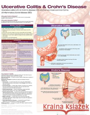 Ulcerative Colitis & Crohn's Disease Anatomical Chart Laminated Anatomical Chart Company   9781496388209 Lippincott Williams and Wilkins - książka